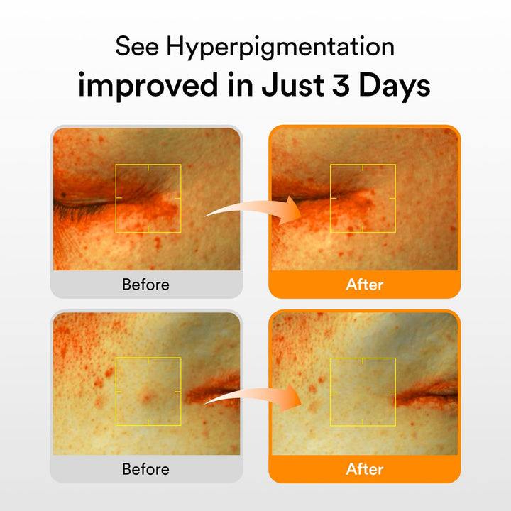 Abib Glutathiosome Dark Spot Serum Vita Drop 50ml