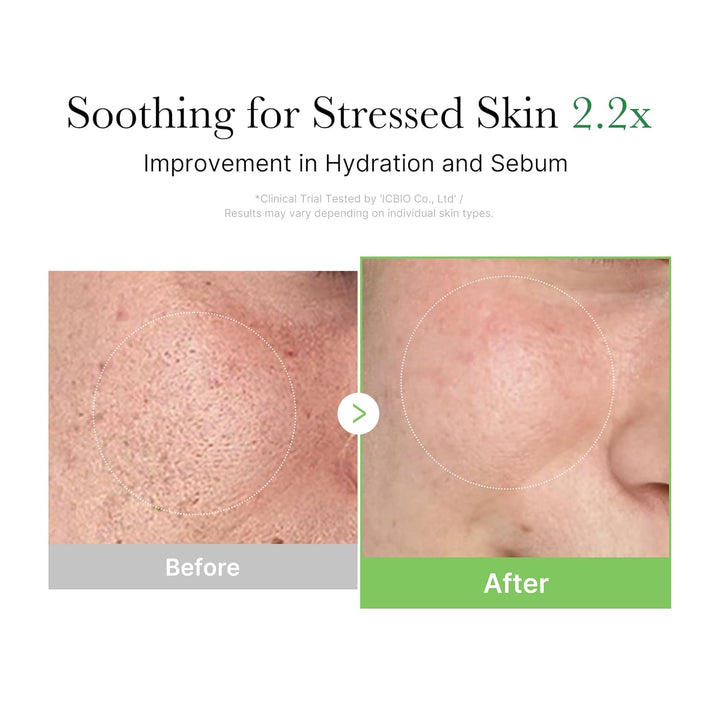 Medicube EXOSOME CICA CREAM 50ML