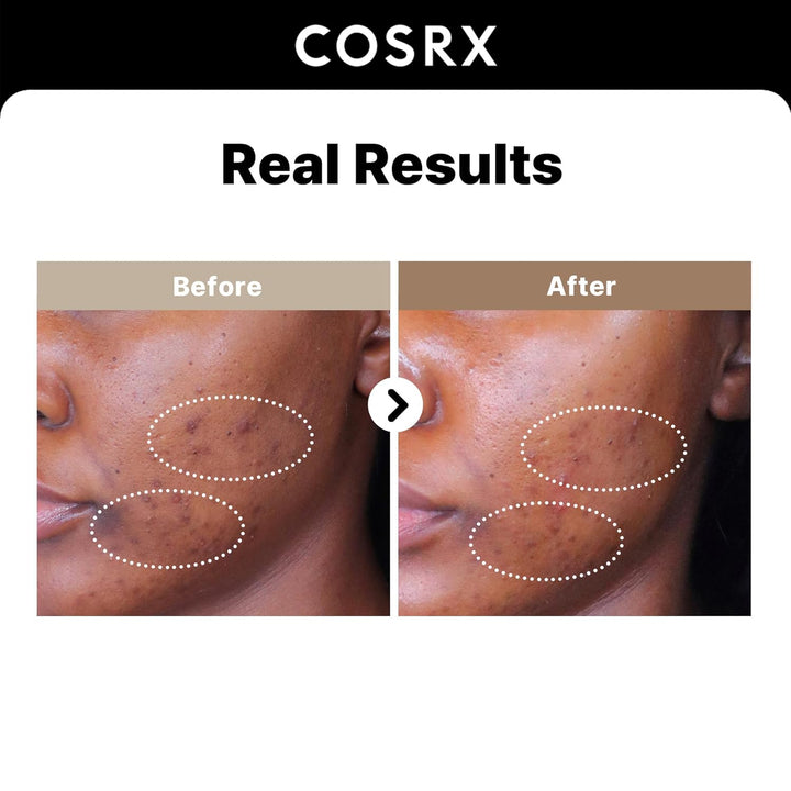 Cosrx The Alpha-Arbutin 2 Discoloration Care Serum 50ml