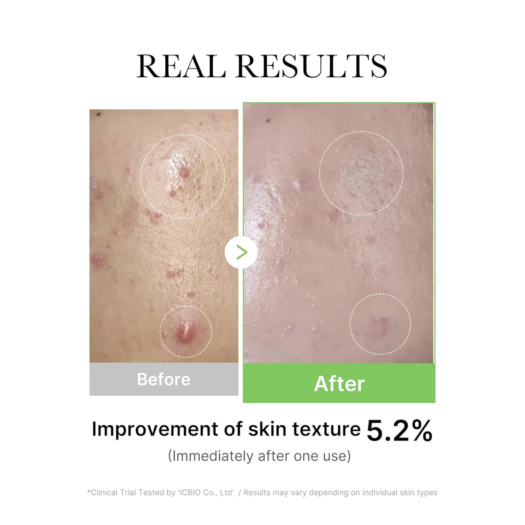 Medicube EXOSOME CICA AMPOULE 30ML