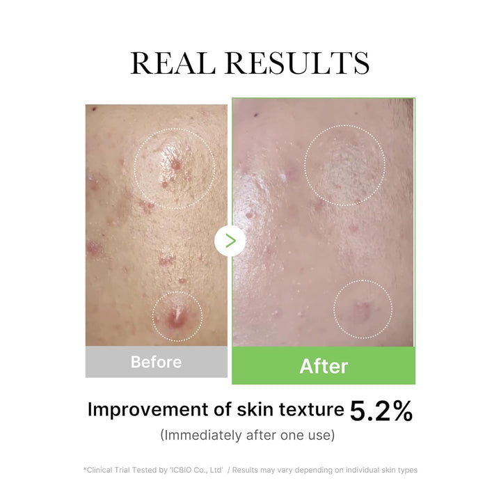 Medicube EXOSOME CICA AMPOULE 30ML