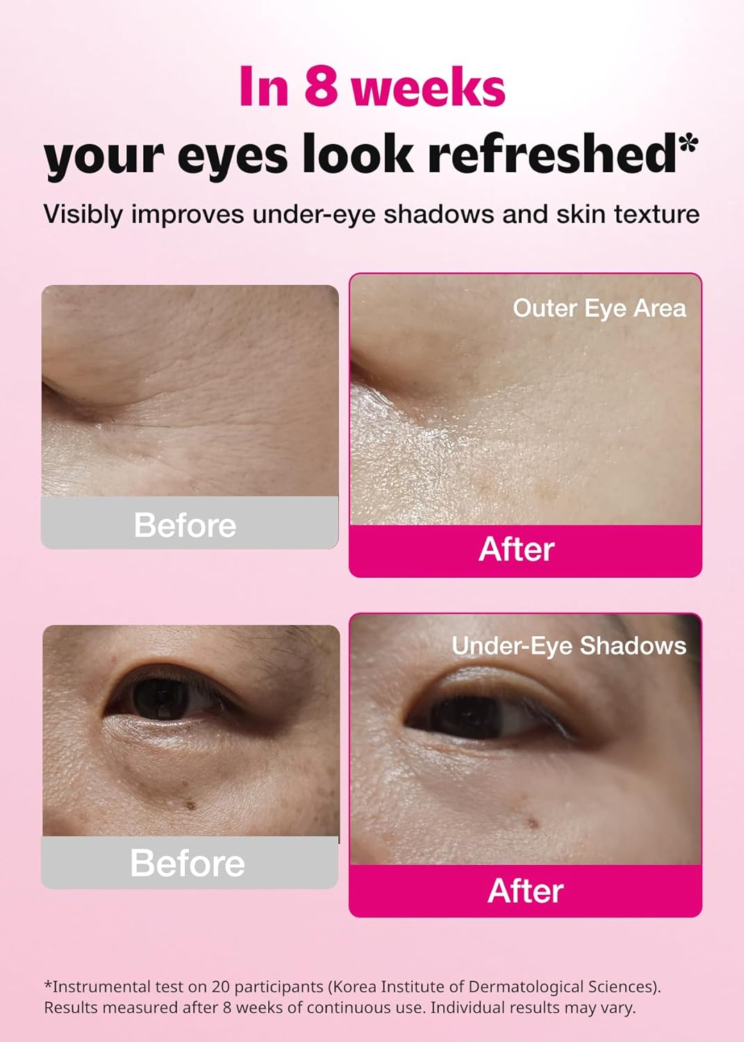 ISOI Blemish Care Eye & Wrinkle Patch