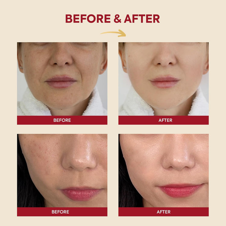 KSECRET SEOUL 1988 Essence : Snail Mucin 97% + Rice 100ml