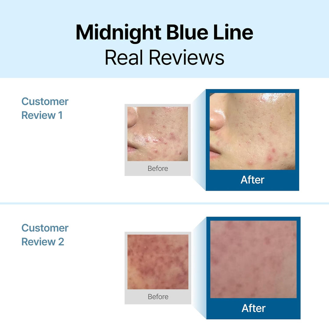 Dear Klairs Midnight Blue Calming Cream 60g