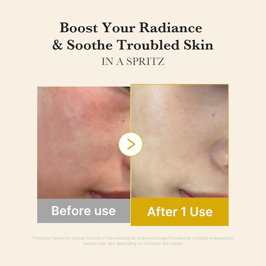 Medicube Kojic Acid Turmeric Vita Jelly Mist Serum 100ml