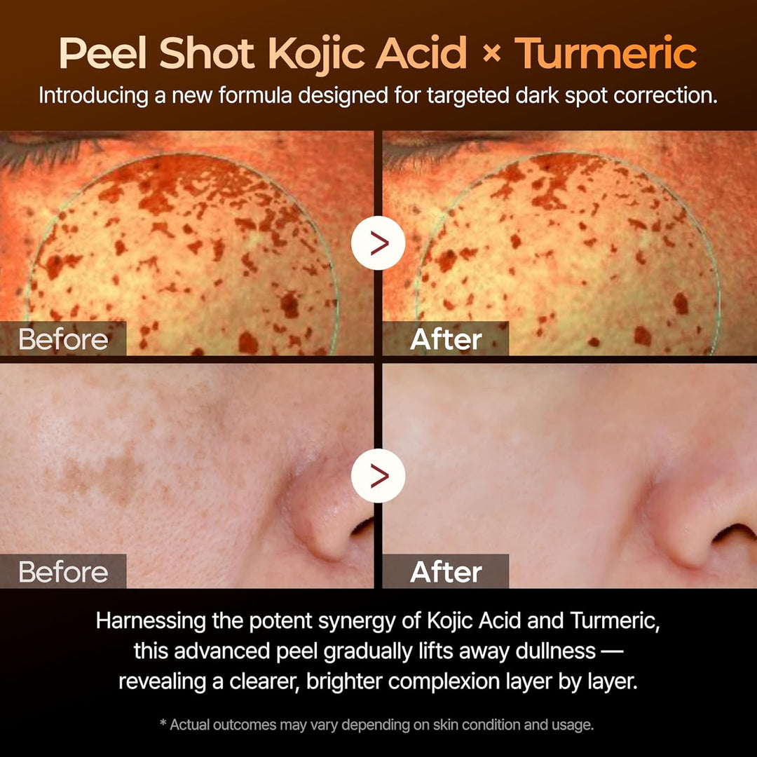 Dr. Melaxin Peel Shot Exfoliating Kojic Acid Turmeric Serum 80ml