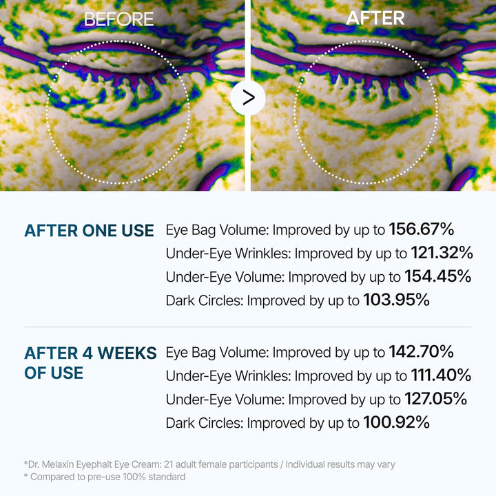 Dr.Melaxin Eyephalt Eyebag Cream 10ml