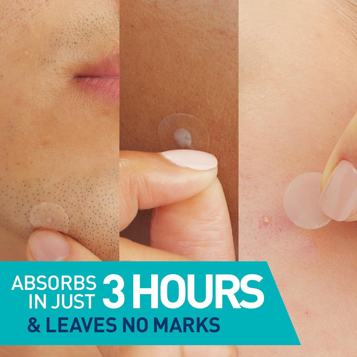 Cerave Blemish Barrier Patches 22 Patches