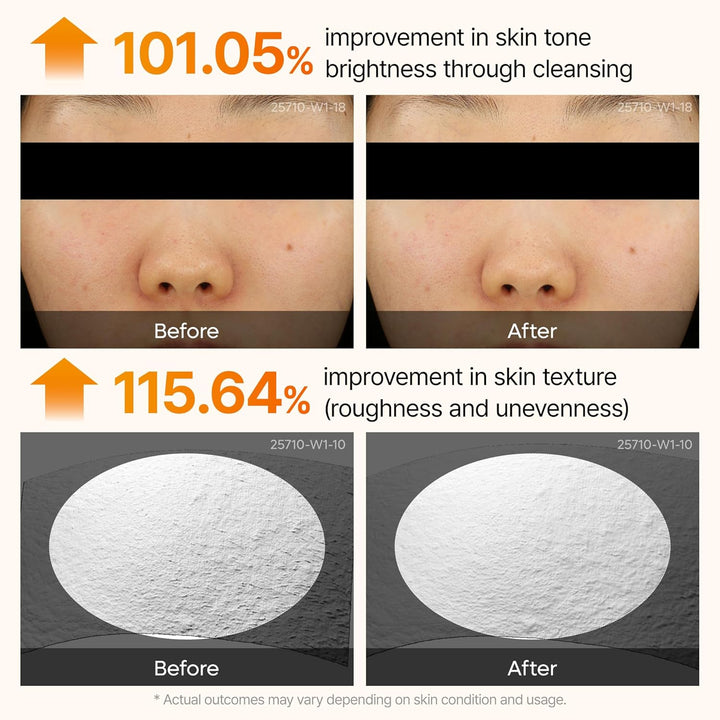 Dr. Melaxin Peel Shot Exfoliating Kojic Acid Turmeric Serum 80ml
