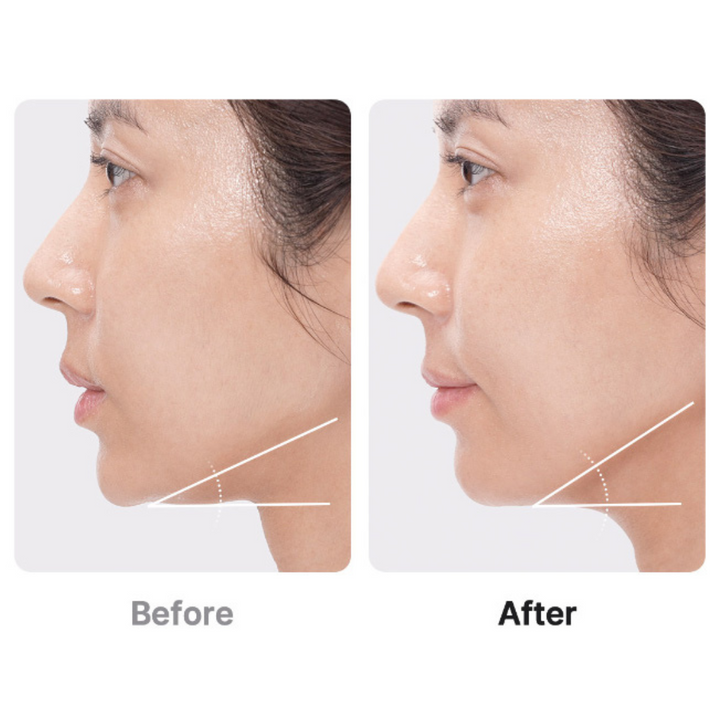 Medicube AGE-R BOOSTER PRO EX PINK | 6-in-1 Glass Skin Total Care Device