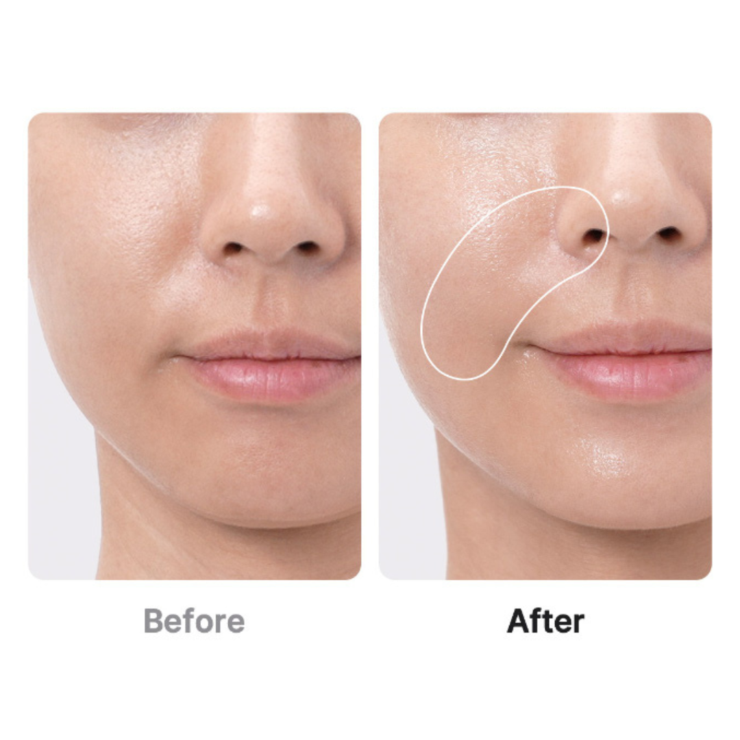Medicube AGE-R BOOSTER PRO EX PINK | 6-in-1 Glass Skin Total Care Device