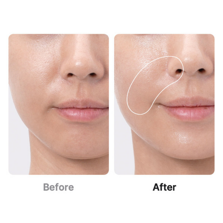 Medicube AGE-R BOOSTER PRO EX PINK | 6-in-1 Glass Skin Total Care Device