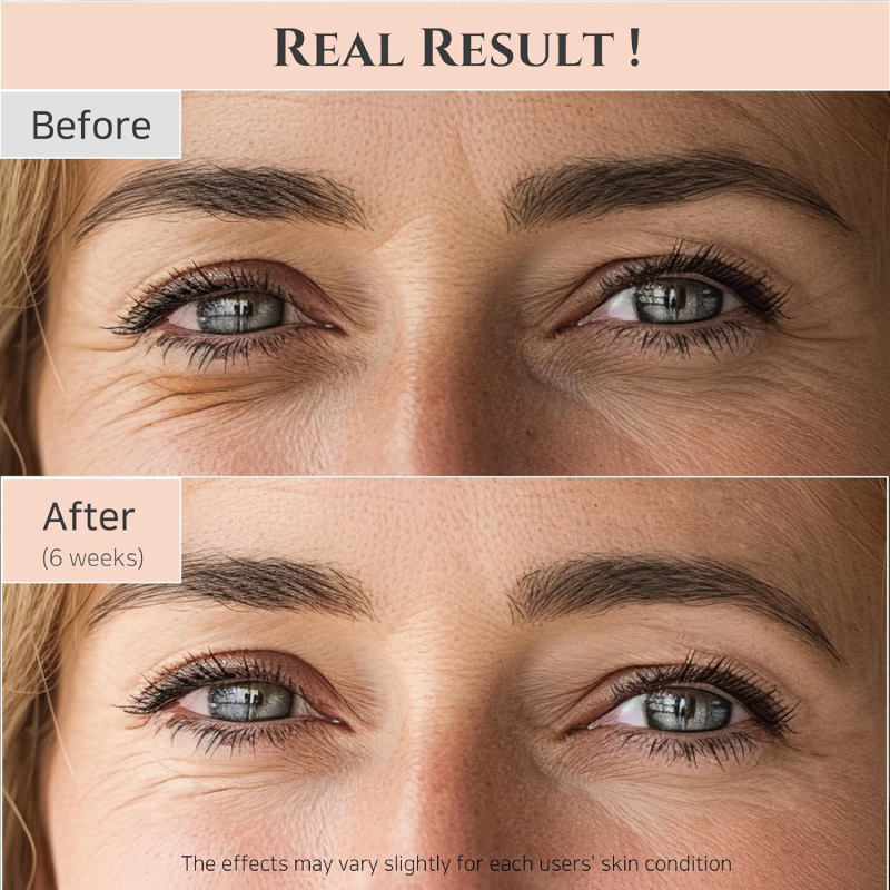 Beauty of Joseon Revive eye serum : Ginseng + Retinal 30ml before and after