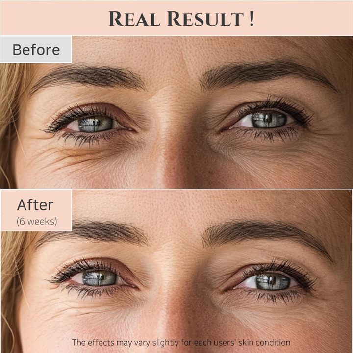 Beauty of Joseon Revive eye serum : Ginseng + Retinal 30ml before and after