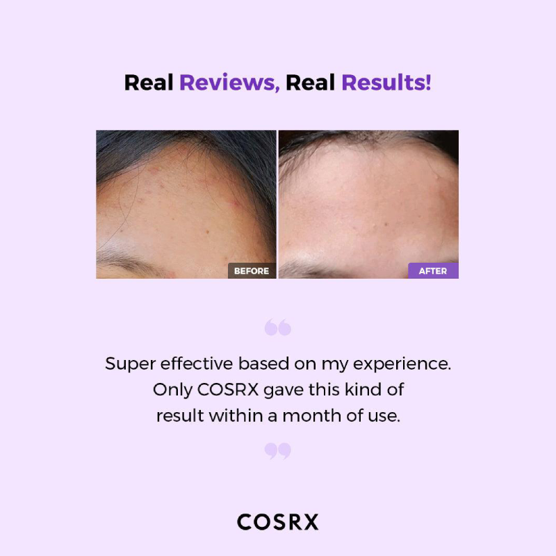 COSRX AHA/BHA Clarifying Treatment Toner reviews