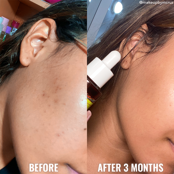 Good Molecules Discoloration Correcting Serum BEFORE AND AFTER