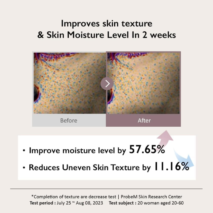 Haruharu Wonder Black Rice Hyaluronic Toner Sensitive Skin 300ml results
