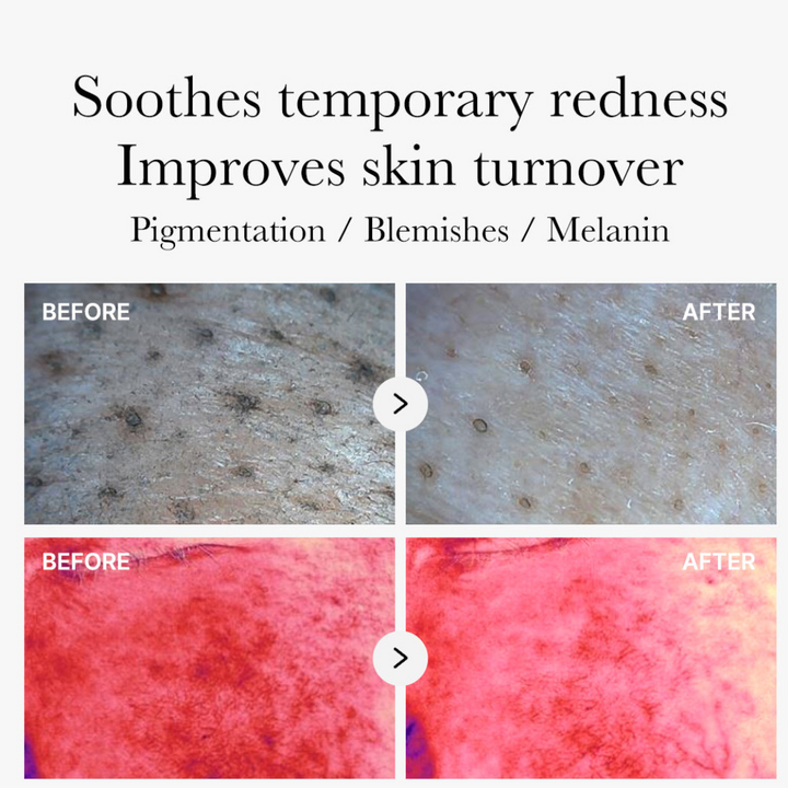 Medicube Red Succinic Acid Peeling Pads 70pcs results