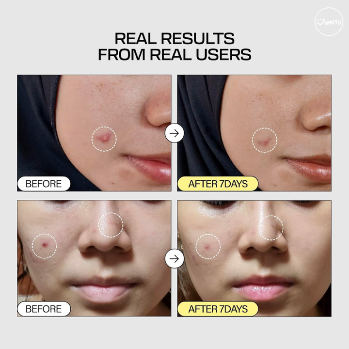 Jumiso Snail Mucin 95% + Peptide Essence