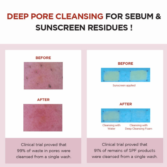 SKIN1004 Madagascar Centella Poremizing Deep Cleansing Foam 125ml results