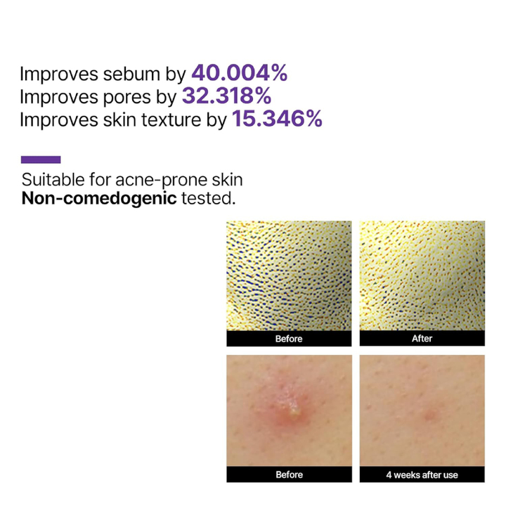 SOME_BY_MI_Retinol_Intense_Reactivating_Serum_30ml_results