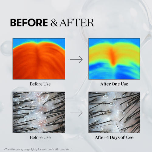 VT Cosmetics PDRN Reedle Shot Hair Ampoule 100dl